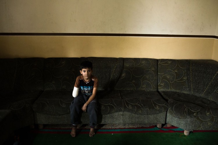 Abdurrahman, 9, teve braço amputado pelo EI em vilarejo próximo a cidade de Qayyarah. (Foto: João Castellano - 16.nov.2016/Folhapress)